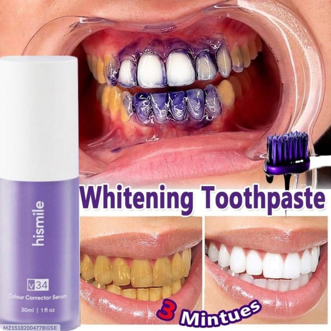 Teeth Whitening Pen - Achieve a Brighter Smile with 1 Pack
