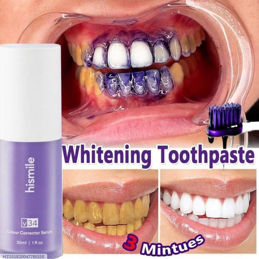 Teeth Whitening Pen - Achieve a Brighter Smile with 1 Pack