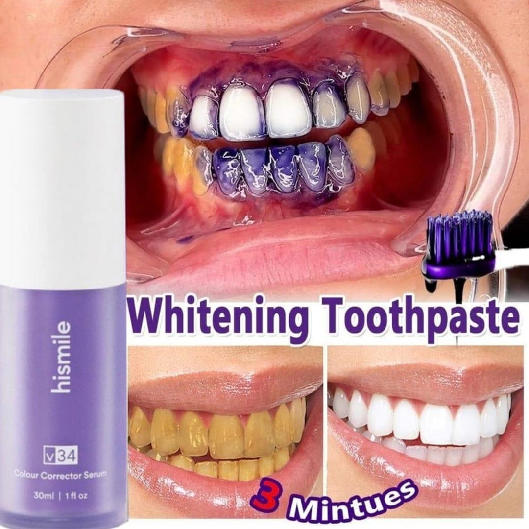 Teeth Whitening Pen - Achieve a Brighter Smile with 1 Pack